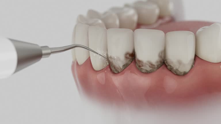 Reliable Dental contractor in Yoakum, TX by Smile Center Dentistry